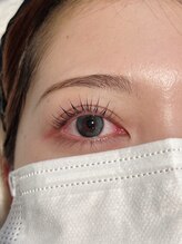 ビオラス(Biolus)/まつ毛パーマ/ラッシュリフト