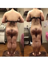 エスプレッソ(espresso,)/【全身痩身20回】体重-6.0kg！