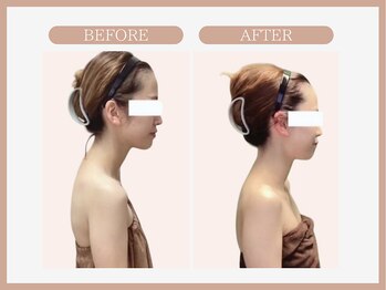 スリムライン 弘前店(The Slim Line)/before→after