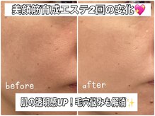 リエル(RIEL)/小顔矯正×美顔筋育成エステ