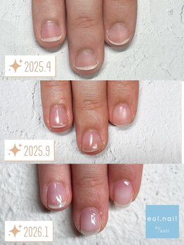 エオル(eol.)/自爪育成☆育爪☆パラジェル