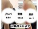 シュール(Sur)の写真