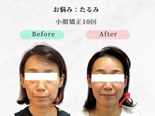 美容整体 ウェリナ 蟹江院/小顔矯正/骨盤矯正/美脚サロン 