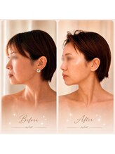 アミュ ル ブラン ナゴヤ(AMU Le blanc NAGOYA)/【症例写真】
