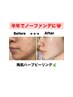 【シミ・くすみ・透明感】+VCF(ビタミンC美容液)|肌荒れ・毛穴ケア