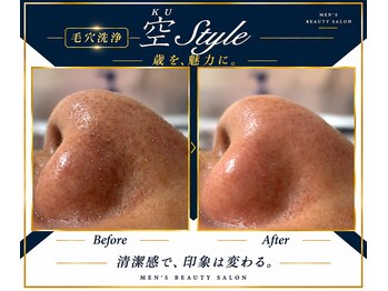 空スタイル(空STYLE)の写真/【沖縄市与儀】毛穴の黒ずみ・開き・ざらつきに。男の毛穴をスッキリ洗浄！