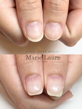 マリーロール 淀屋橋本店(Marie Laure)/自爪育成/深爪矯正/ネイルケア