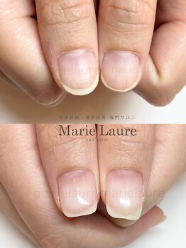マリーロール 淀屋橋本店(Marie Laure)/自爪育成/深爪矯正/ネイルケア