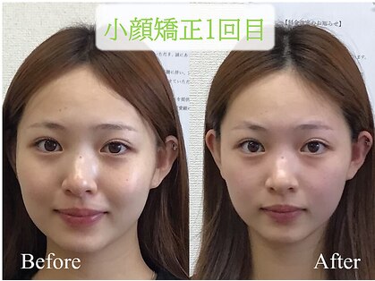 オズ六本木の写真