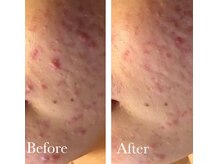 MMK/なめらか素肌を手に入れる