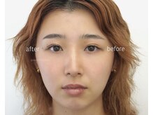 ハリウッドブロウリフト ワクシー 表参道店(HOLLYWOOD BROW LIFT WAXYYY.)/新HBL+まつ毛セットメニュー♪