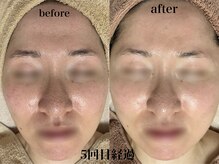 フェイシャルサロン アリイ(ALII)/