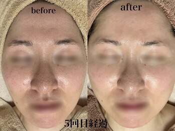 フェイシャルサロン アリイ(ALII)/