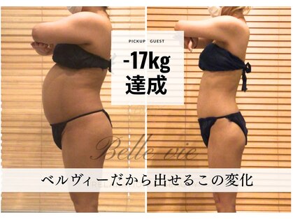 ベルヴィーの写真