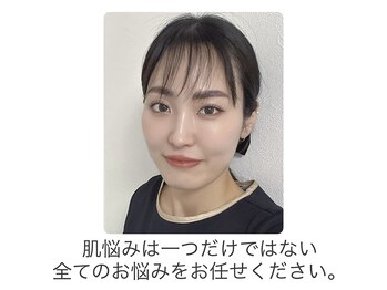 ステラ(Stella)/“毛穴改善はお任せください“