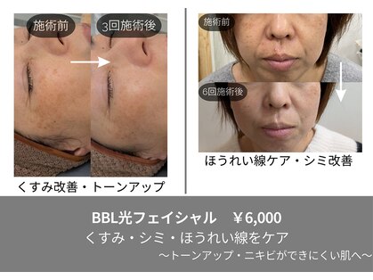 ティンクル サロン(Twinkle salon)の写真