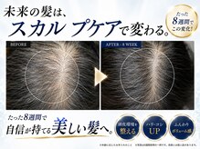 BLD/クリニカルスカルプケアB&A