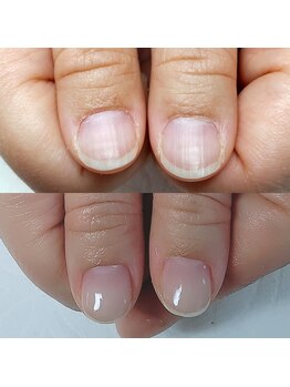 グラーティア(Gratia)/自爪育成クリアジェルコース