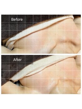 コモレビ(COMOREBI)/バザルトボディデコルテ☆