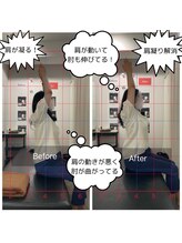 ナオル整体 銀座院(NAORU整体)/肩凝り改善　before after