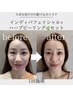 【小顔×お悩み別,肌管理トータルケア】インディバfacial×ハーブピーリング
