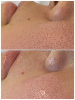 ギャラクシービューティー(galaxy beauty)/お肌に透明感