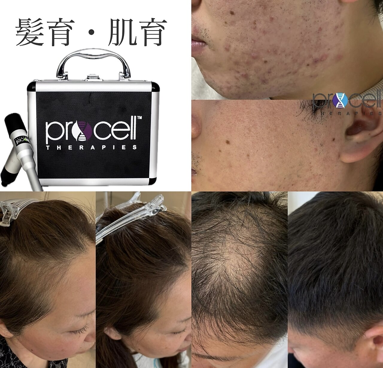 クレア(crea)｜ホットペッパービューティー