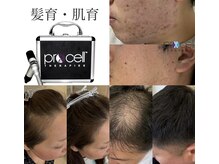 クレア(crea)