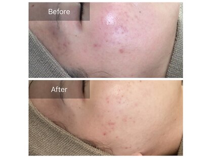 素肌研究所BSラボの写真