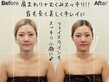 リストアハート(Restore Heart)