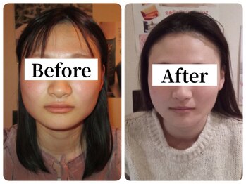 マンマ ジュンナ/【浜松/小顔/小顔矯正】