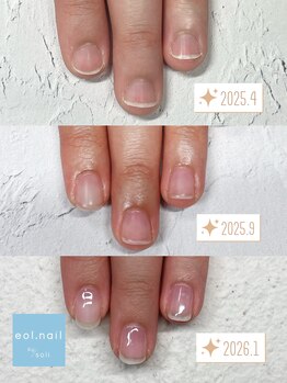 エオル(eol.)/自爪育成☆育爪☆フィルイン