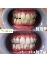 ルブラン 奈良店(Le Blanc)/清潔にしていますか？？