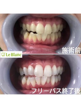 ルブラン 奈良店(Le Blanc)/清潔にしていますか？？