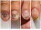 エマネイル(emma nail)の写真