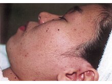 クリニカルエステクリア 梅田店/★フェイシャル★