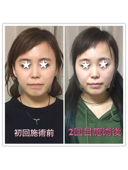 ラ アクサル(la.akthar)/小顔 全身 骨格矯正 整体