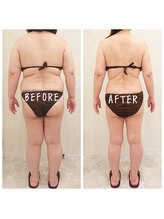 デジール(DESIR)/１０か月の経過★本気の痩身