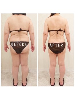 デジール(DESIR)/１０か月の経過★本気の痩身