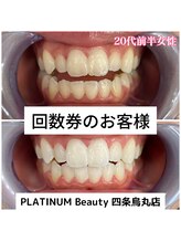 プラチナムビューティ 四条烏丸店(PLATINUM Beauty)/回数券ご利用のお客様