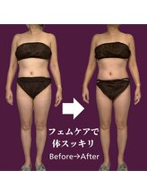 パラアモール(Paraamor)/ボディラインが綺麗になる