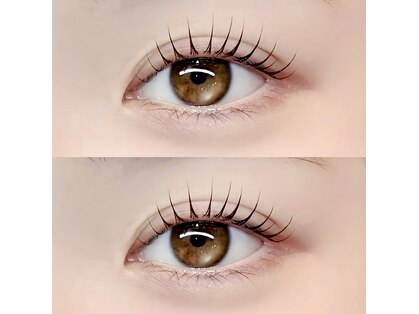 ブリンクアイ(blink eye)の写真