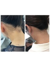 ミース 熊本店/うなじ矯正◆ビフォーアフター