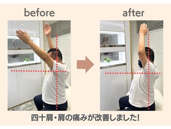 フィクシブ 上野(FIXIBE)/肩が挙がるように!