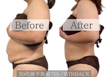 プランツ(PLANTS)