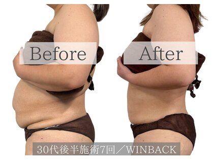 プランツ(PLANTS)の写真