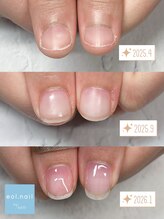 エオル(eol.)/自爪育成☆育爪☆パラジェル