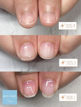 エオル(eol.)/自爪育成☆育爪☆パラジェル