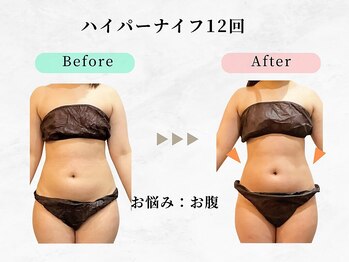 美容整体 ウェリナ 蟹江院/小顔矯正/骨盤矯正/美脚サロン 