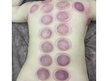 リベル(Liber)/寝不足とストレス疲れのお客様